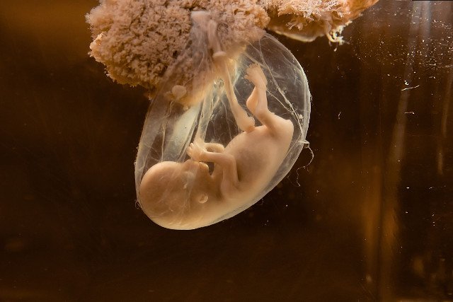 Prawo autorskie: leptospira / 123RF Zdjęcie Seryjne