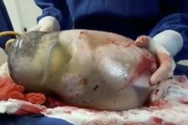 Niecodzienny widok ukazał się lekarzom kliniki w Brazylii