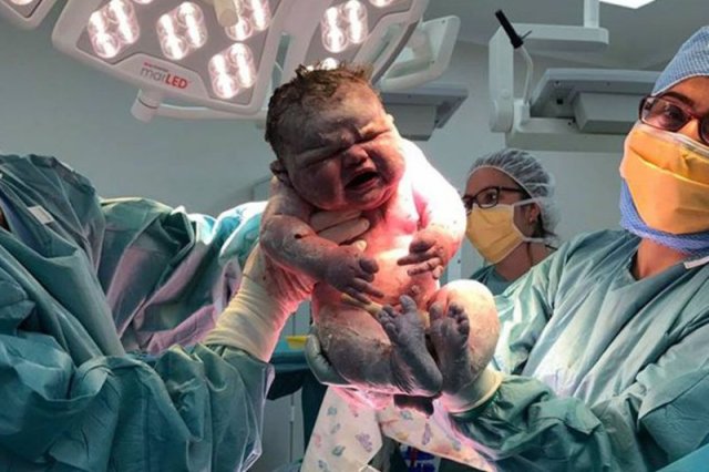 Dziewczynka w chwili narodzin ważyła ponad 6 kg.