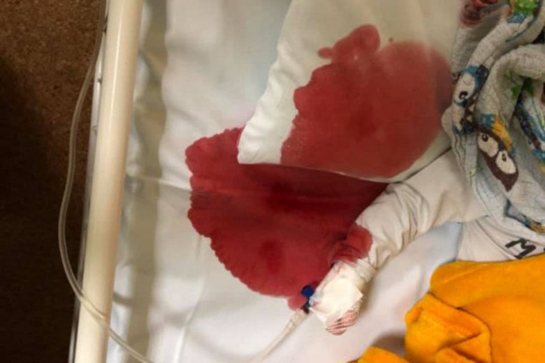 Kobieta z dzieckiem czekała na szpitalnym korytarzu w Wejherowie 4 godziny.